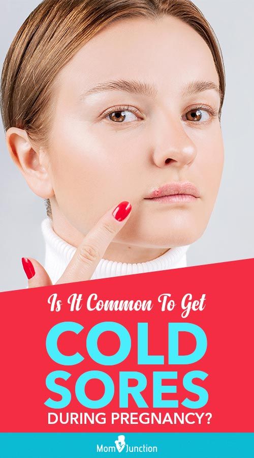 How Common Are Cold Sores Fever Blisters During Pregnancy