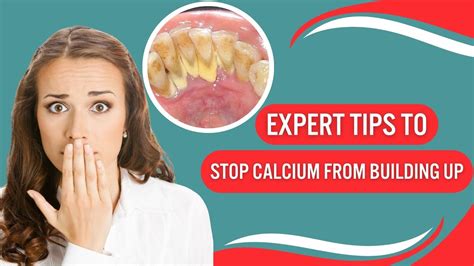 How To Get Rid Of Calcium Deposits On Teeth Health Advisor