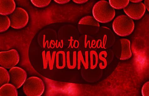 How To Heal Wounds Faster Best Remedies Useful Tips