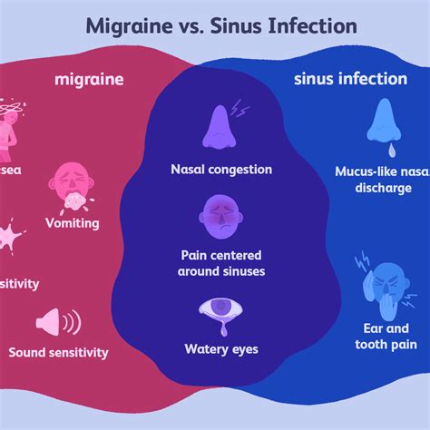 How To Help Sinus Headaches Classeconomy3