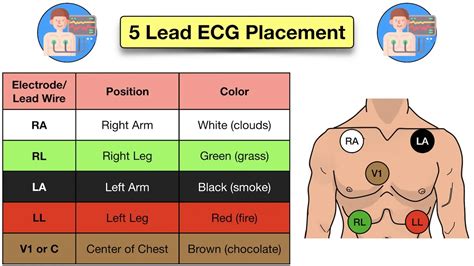 How To Place A 5 Lead Ecg Acronym Mnemonic Diagram For Electrode