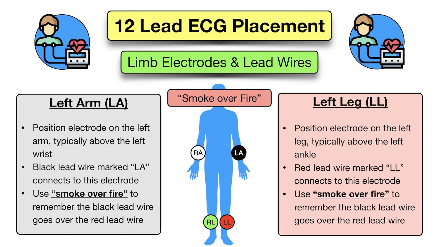 How To Place A 5 Lead Ecg Mnemonic Electrode Placement Made Easy