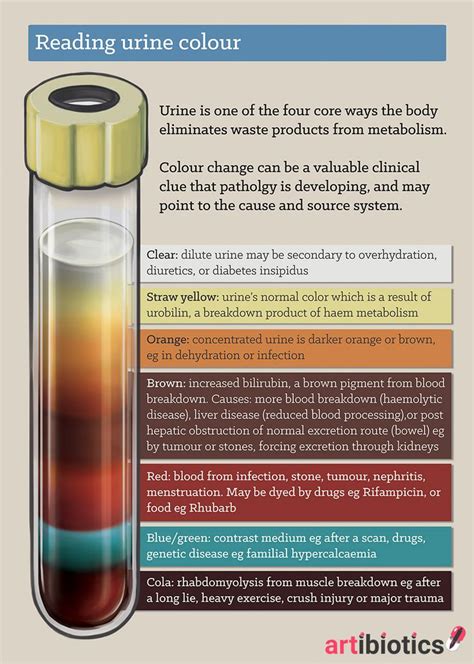How To Read Urine Colour Artibiotics