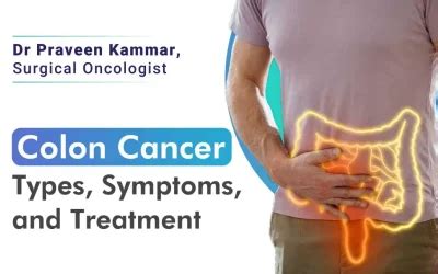 How To Spot The Last Symptoms Of Colon Cancer Dr Praveen Kammar