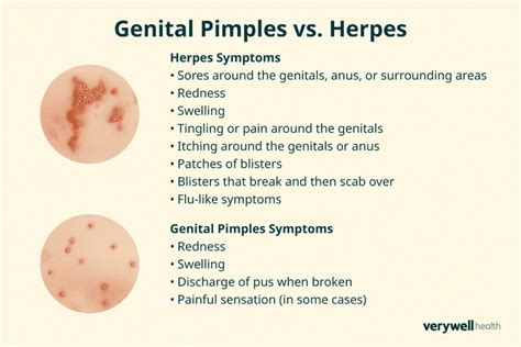 How To Tell The Difference Between Herpes And Pimples With Photos