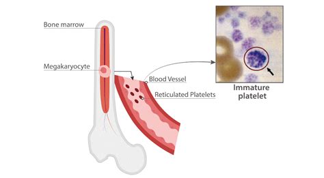 5 Tips Immature Platelet Fraction