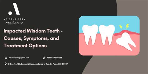 Impacted Wisdom Teeth Symptoms Causes Treatment And Diagnosis