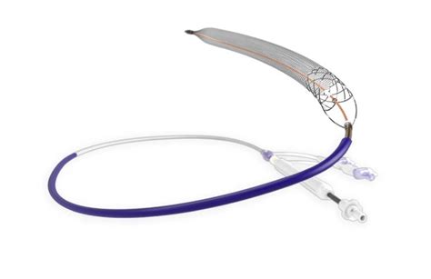 Inari Medical Has Positive Clottriever Data