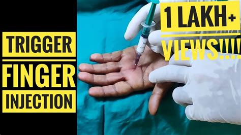 Injection Technique For Trigger Finger Youtube