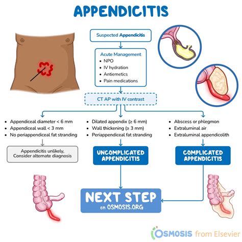 Is Appendicitis Hereditary