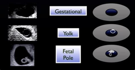 5 IUP Medical Abbreviation Facts