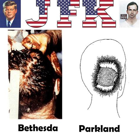 JFK Autopsy Photos Revealed