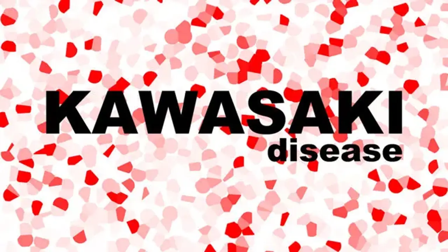 Kawasaki Disease Criteria
