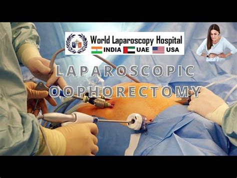 Laparoscopic Salpingo Oophorectomy For Recurrent Endometrioma A