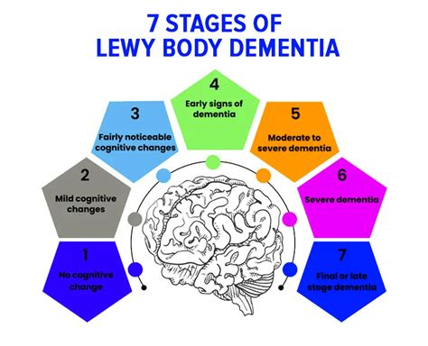 Lewy Body Dementia Specialist Diagnosis Treatment