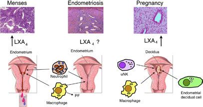Lipoxin A4 Lxa4 Mediated Actions In The Endometrium At Menses And In