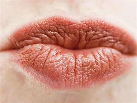 Mono Can You Get Mono Twice