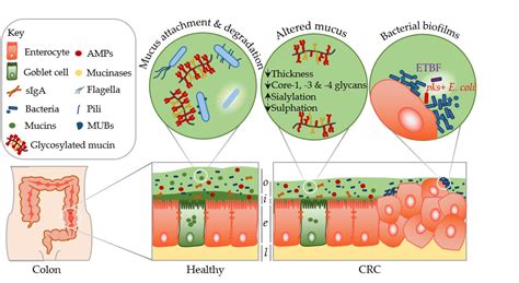 Mucus In Stool Colon Cancer