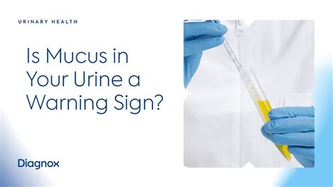 Mucus When Urinating