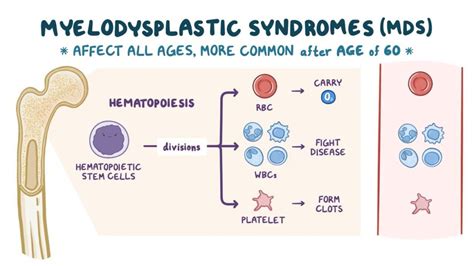 Myelodysplastic Syndrome