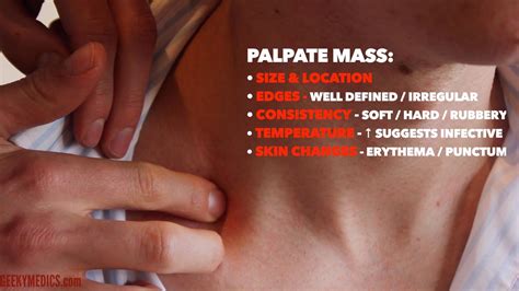 Neck Lump Examination Osce Guide Geeky Medics