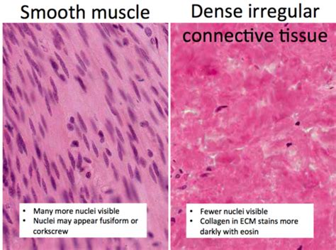 Nerve Vs Smooth Muscle Vs Dense Regular Connective Tissue Tendon Fascia