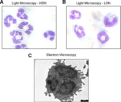 Neutrophil Morphology Light Microscopy Image Of High Density A And