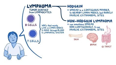 Hodgkin's vs Non Hodgkin's Lymphoma Difference