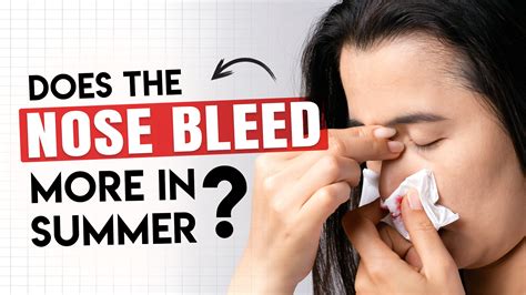 Nosebleeds What To Do When Your Nose Bleeds The Chestermere Anchor