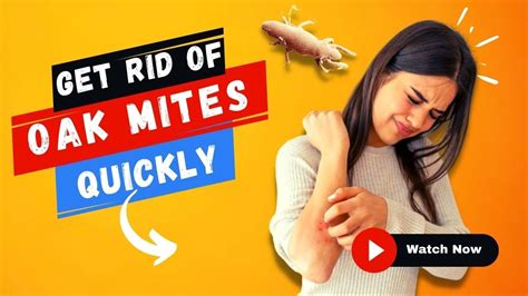 Oak Itch Mites Treatments Bugspray Treatment