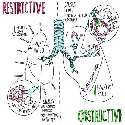 Obstructive Airway Disease Vs Restrictive