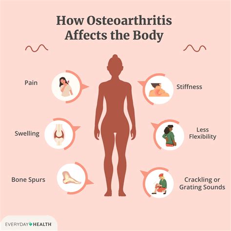 Osteoarthritis Symptoms And Causes