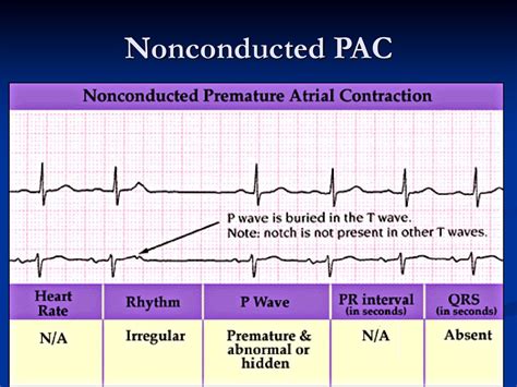 Pac And Nonconducted Pac