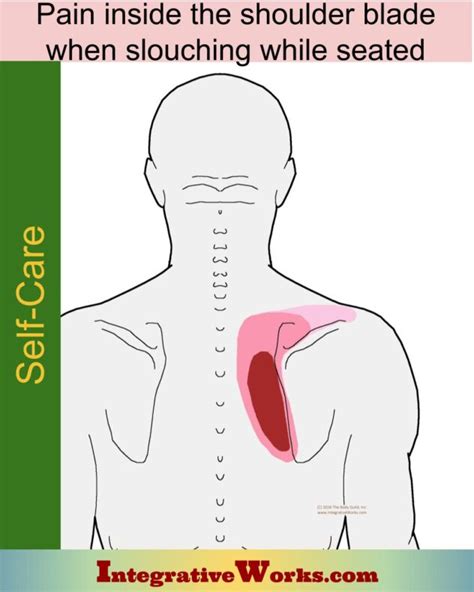 Pain Between Shoulder Blades Pain Patterns Causes Self Care