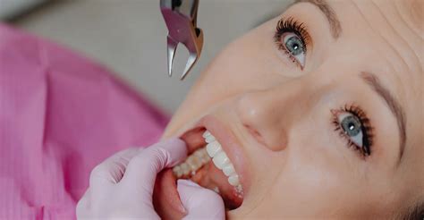 Painless Wisdom Teeth And Dental Extractions 24H Emergency