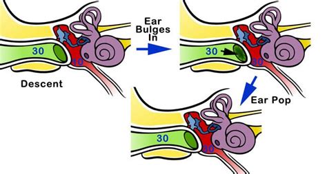 Popping Noise In Ear