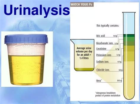 Ppt Urinalysis Powerpoint Presentation Id 5498707