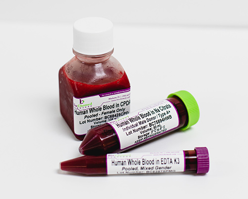 Prbc Packed Red Blood Cells In Medical By Acronymsandslang Com