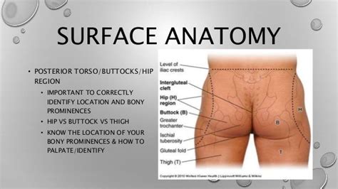 Pressure Areas On Buttocks Bing Wound Care Thighs Greater Trochanter