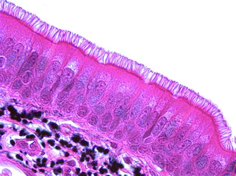 5 Facts Pseudostratified Ciliated Columnar