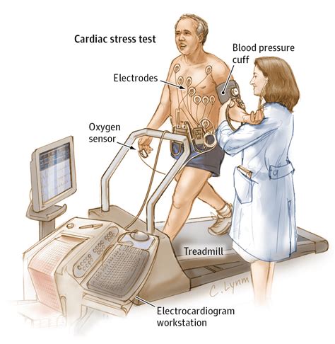 Reporting Cardiac Stress Tests Sunrise Services Llc