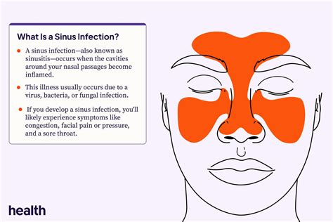 Sinus Infection Signs Causes Symptoms Treatment