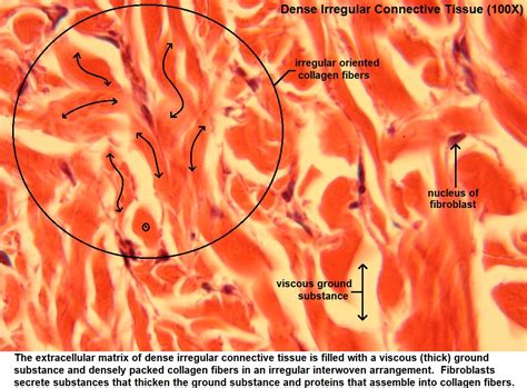 Solved Obtain A Slide Of Dense Irregular Connective Tissue From The