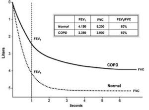 Spirometry Copd Fev1 Fvc At Marie Kwon Blog