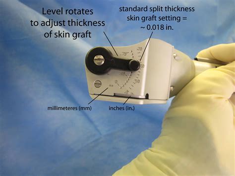 Split Thickness Skin Graft Stsg Zimmer Dermatome Settings With Video