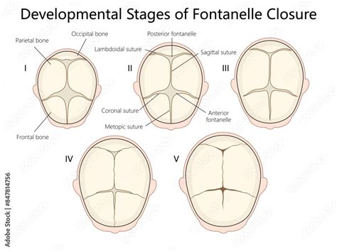 Stages Fontanelle Closure Diagram Medical Science Vector Image