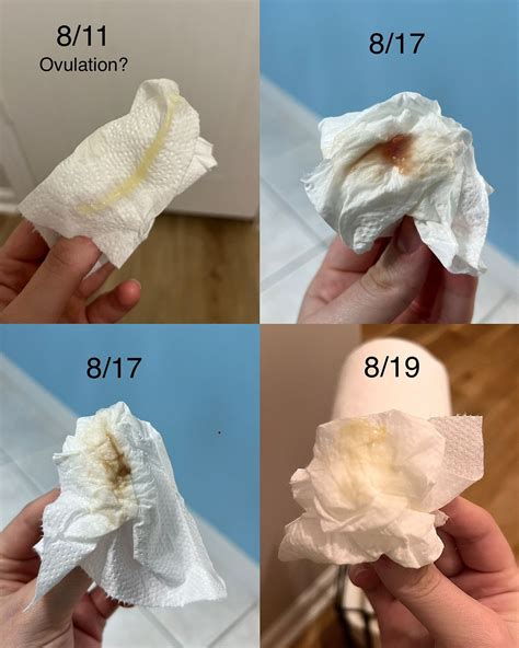 Started Spotting After Ovulation Is It Implantation Clomid Cycle