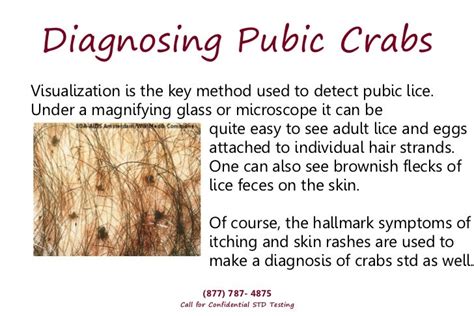 Std Pictures Of Crabs