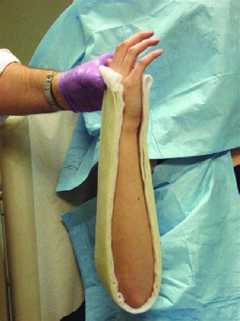 5 Sugar Tong Splint Tips