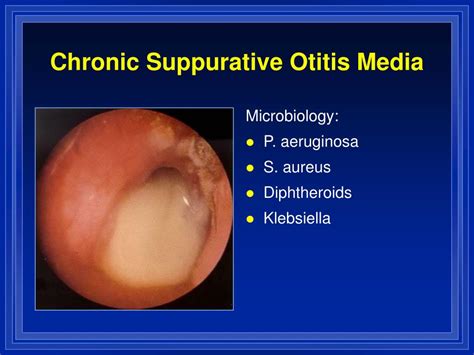 Suppurative Otitis Media